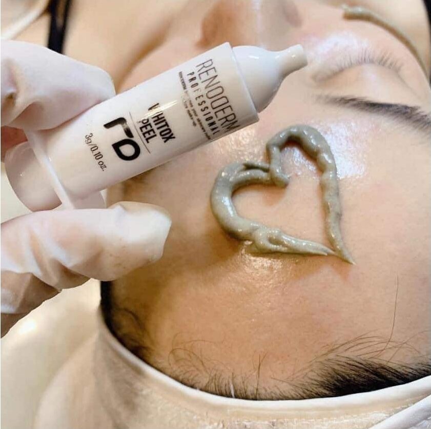 peeling au spicule d'algues peeling whitox renoderm korean beauty